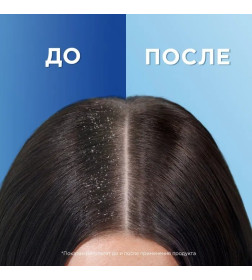 Шампунь Head & Shoulders Основной уход 400мл  